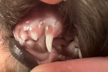Close-up of Aiko's mouth showing improved alignment of her lower canine tooth after early treatment for dental malocclusion.