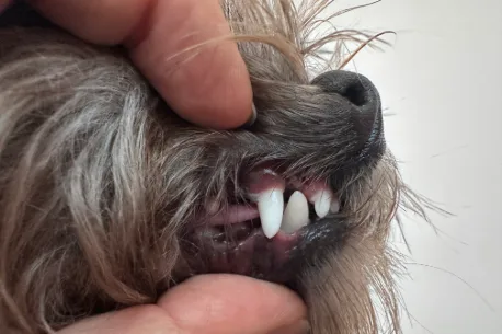 Close-up of Aiko’s teeth at her follow-up appointment showing improved spacing and canine alignment after extractions.