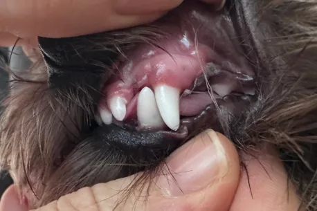 Side view of Aiko’s teeth at her follow-up appointment showing improved alignment after treatment for dental malocclusion.